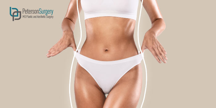 Debunking Liposuction Myths